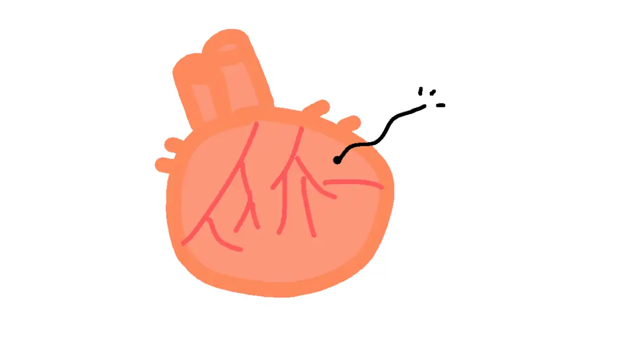 心臓に毛が生える